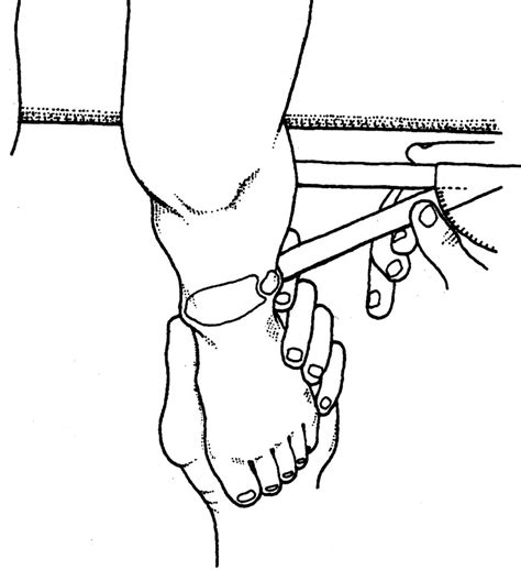 test for tibial torsion|tibial torsion special test.